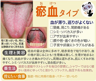 気・血・水タイプ別診断表 体質診断】不調の原因は？「気・血・水」7タイプ別の傾向と対策